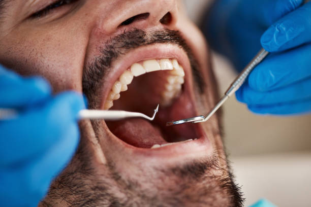 Best Emergency Dental Care for Trauma or Injury in Saegertown, PA